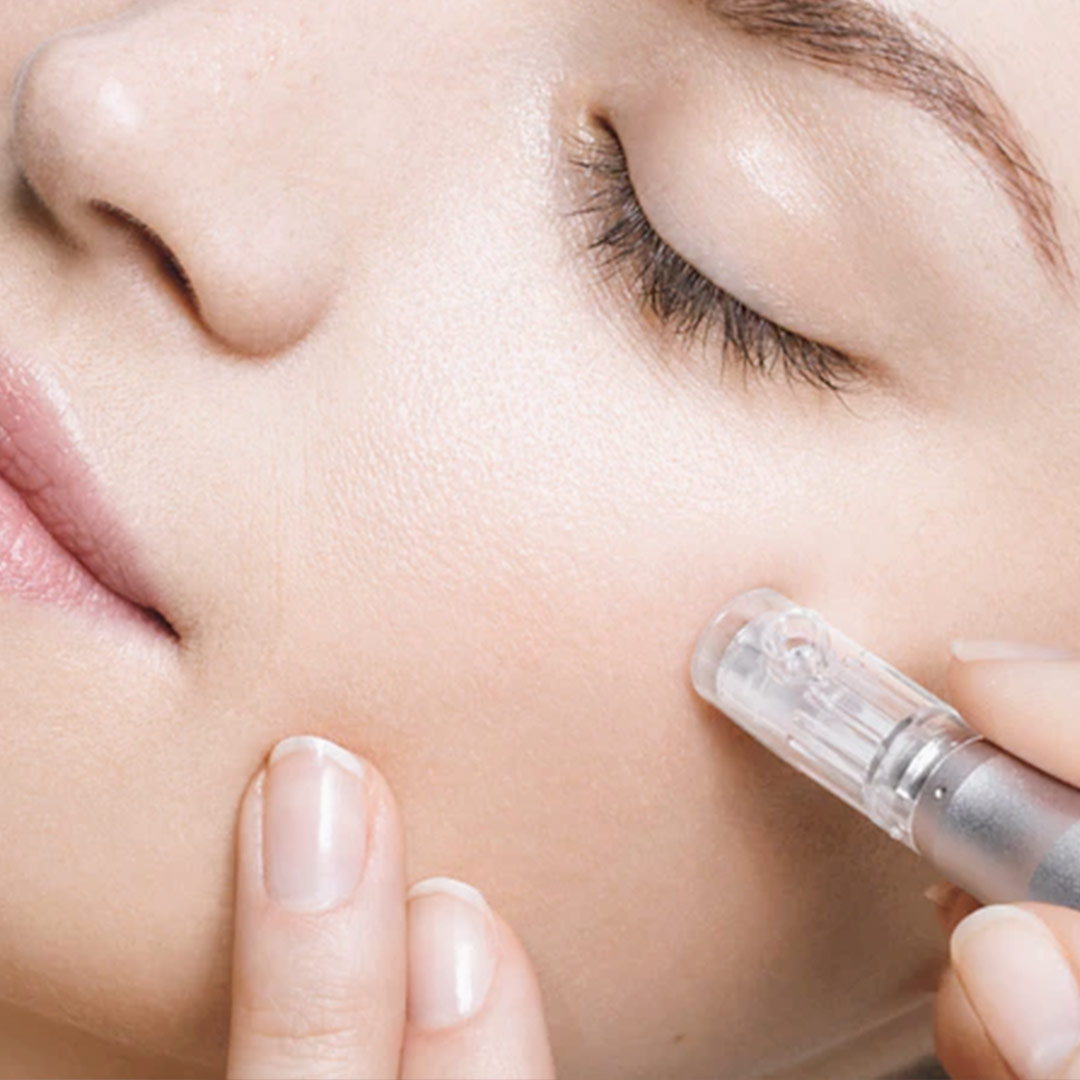 Microneedling
